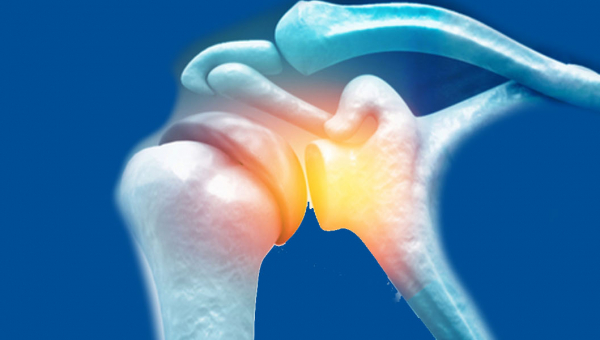 عملية منظار الكتف في الهند 