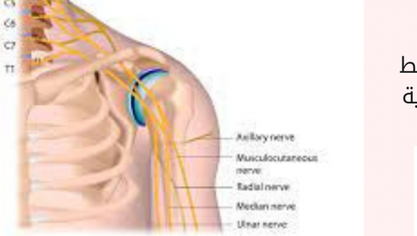 عملية إصابة الضفيرة العضدية في الهند