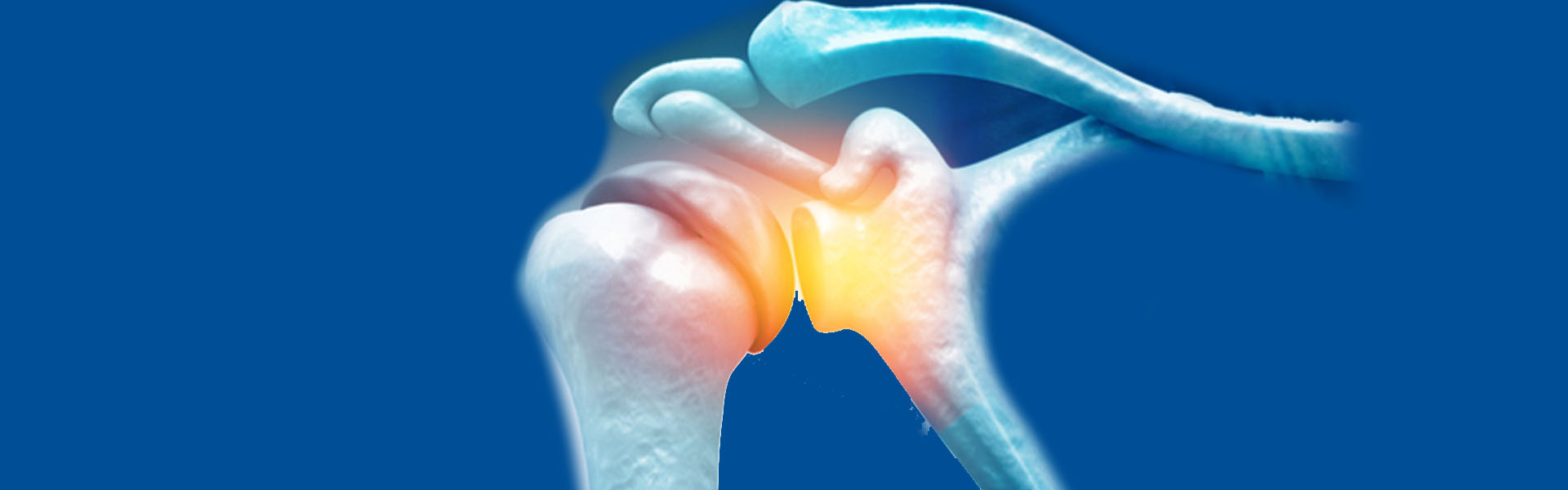 عملية منظار الكتف في الهند  | رعاية متقدمة وخبرة عالية